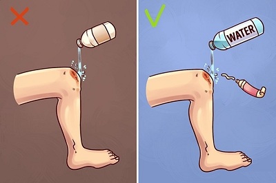 first-aid-methods1 image