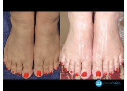 school-chalao-feet-whitening-pedicure-at-home-by-simple-beauty-secrets.jpg