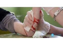 school-chalao-how-to-first-aid-for-stop-bleeding.jpg