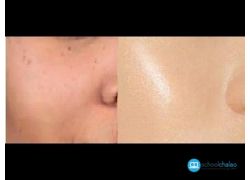 school-chalao-how-to-get-crystal-clear-glowing-skin-spotless-skin-tone-detan-pimple-clean.jpg